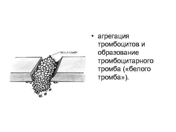  • агрегация тромбоцитов и образование тромбоцитарного тромба ( «белого тромба» ). 