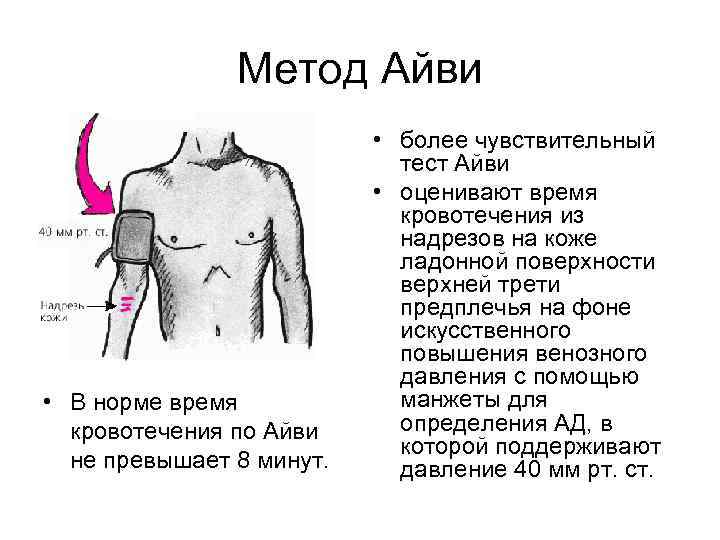 Метод Айви • В норме время кровотечения по Айви не превышает 8 минут. •