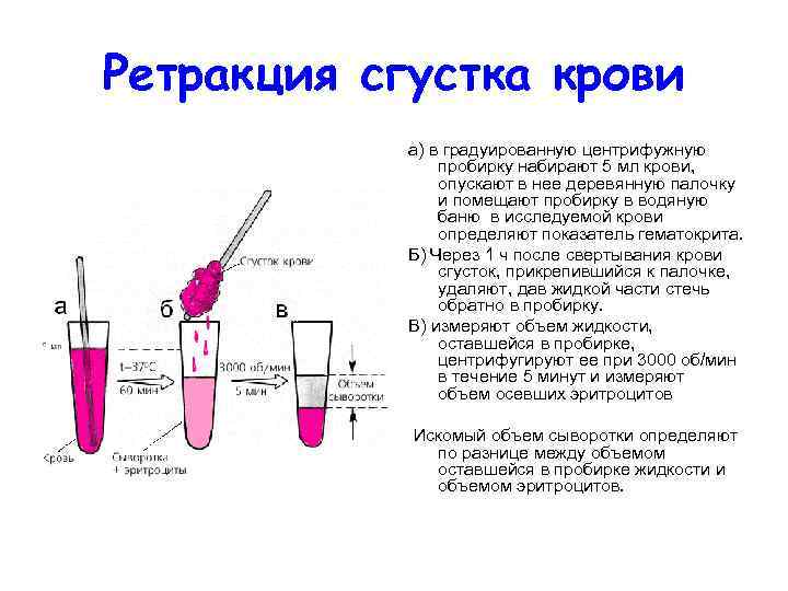 Ретракция сгустка крови а) в градуированную центрифужную пробирку набирают 5 мл крови, опускают в