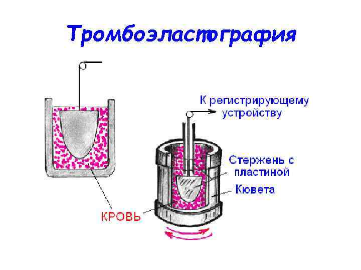 Тромбоэластография 