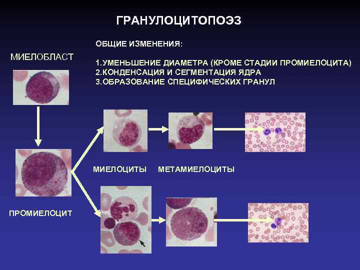 ГРАНУЛОЦИТОПОЭЗ ОБЩИЕ ИЗМЕНЕНИЯ: МИЕЛОБЛАСТ 1. УМЕНЬШЕНИЕ ДИАМЕТРА (КРОМЕ СТАДИИ ПРОМИЕЛОЦИТА) 2. КОНДЕНСАЦИЯ И СЕГМЕНТАЦИЯ