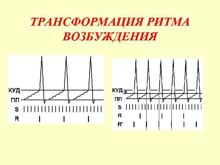 ТРАНСФОРМАЦИЯ РИТМА ВОЗБУЖДЕНИЯ 