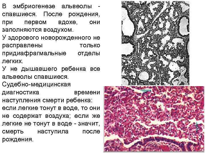 В эмбриогенезе альвеолы спавшиеся. После рождения, при первом вдохе, они заполняются воздухом. У здорового