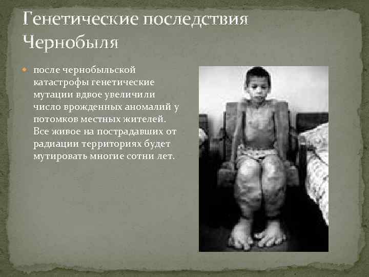 Генетические последствия Чернобыля после чернобыльской катастрофы генетические мутации вдвое увеличили число врожденных аномалий у