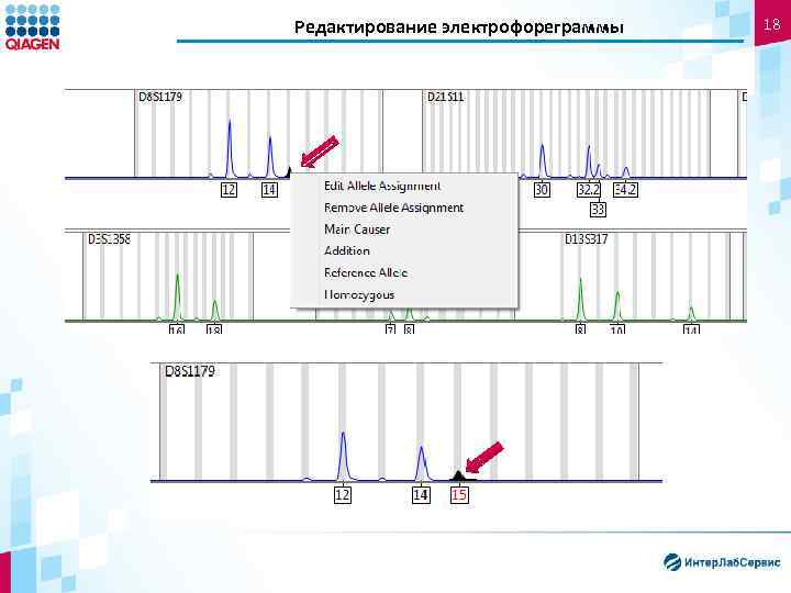 Редактирование электрофореграммы 18 