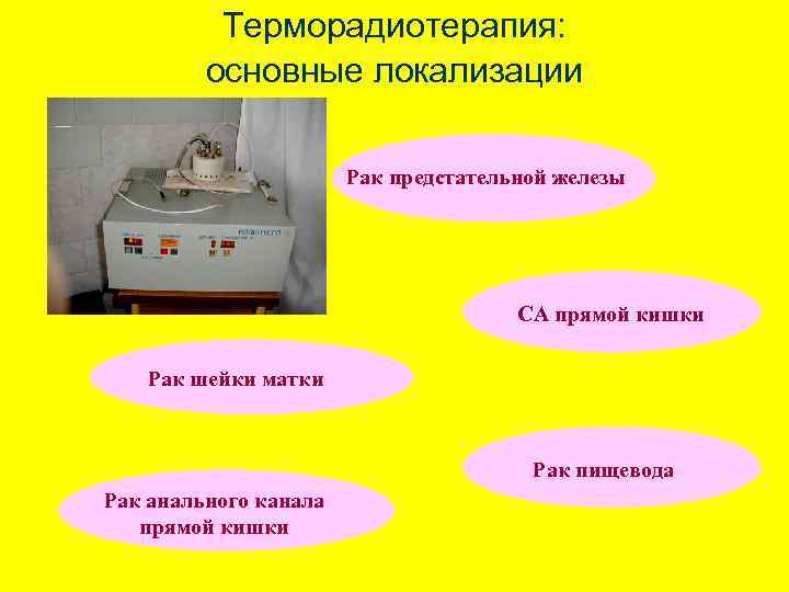 Терморадиотерапия: основные локализации Рак предстательной железы СА прямой кишки Рак шейки матки Рак пищевода