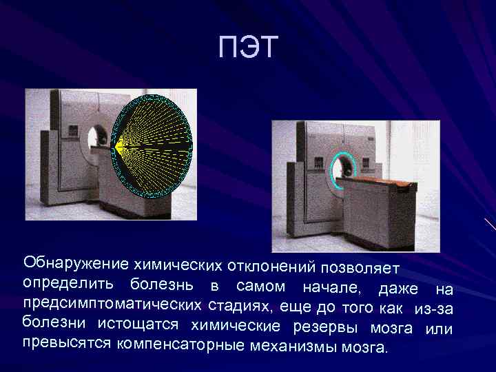 ПЭТ Обнаружение химических отклонений позволяет определить болезнь в самом начале, даже на предсимптоматических стадиях,