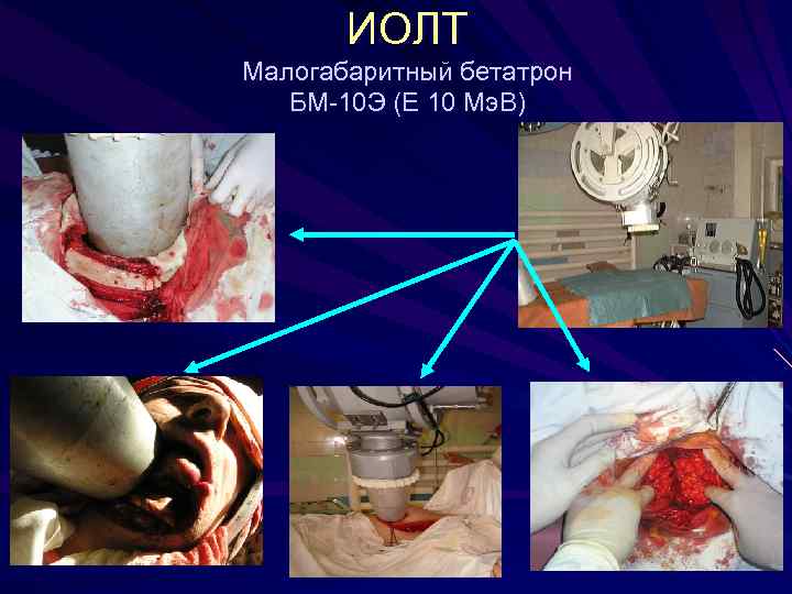 ИОЛТ Малогабаритный бетатрон БМ-10 Э (Е 10 Мэ. В) 