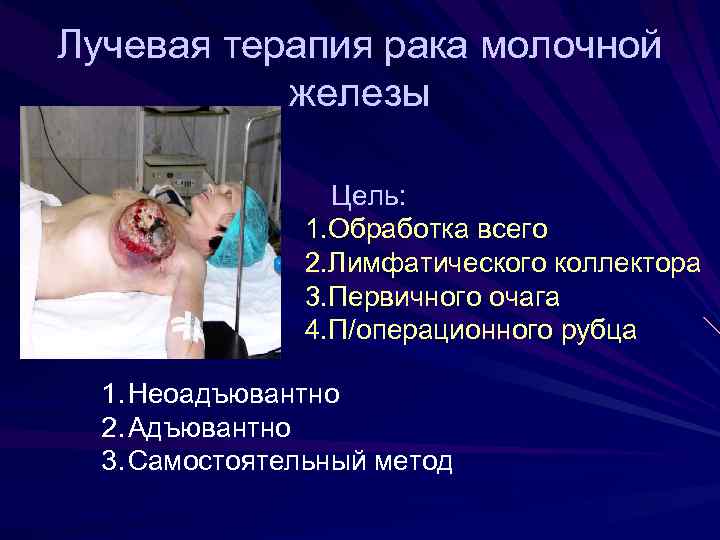 Лучевая терапия рака молочной железы Цель: 1. Обработка всего 2. Лимфатического коллектора 3. Первичного