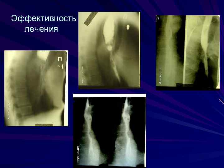  Эффективность лечения 