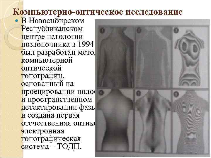 Компьютерно-оптическое исследование В Новосибирском Республиканском центре патологии позвоночника в 1994 г. был разработан метод