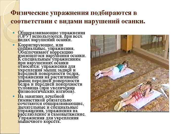 Физические упражнения подбираются в соответствии с видами нарушений осанки. Общеразвивающие упражнения (ОРУ) используются. при