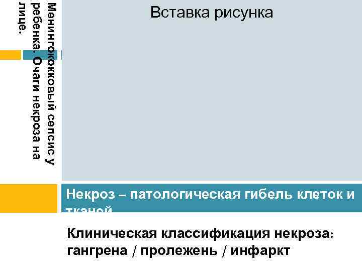 Менингококковый сепсис у ребенка. Очаги некроза на лице. Вставка рисунка Некроз – патологическая гибель
