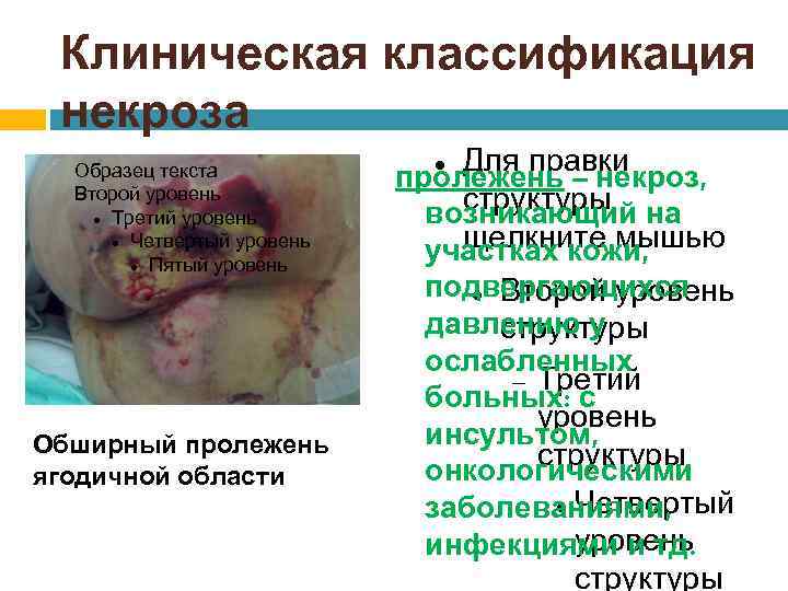Клиническая классификация некроза Образец текста Второй уровень Третий уровень Четвертый уровень Пятый уровень Обширный