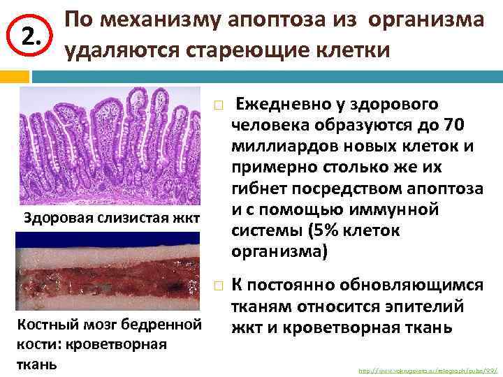 По механизму апоптоза из организма 2. удаляются стареющие клетки Здоровая слизистая жкт Костный мозг