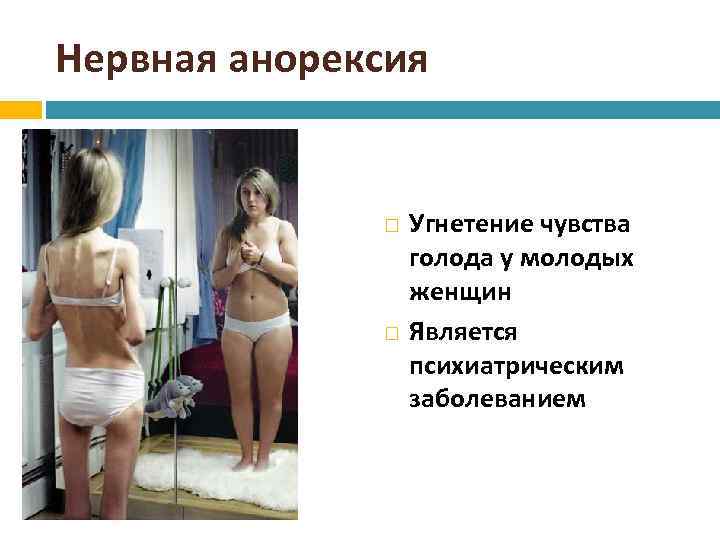 Нервная анорексия Угнетение чувства голода у молодых женщин Является психиатрическим заболеванием 