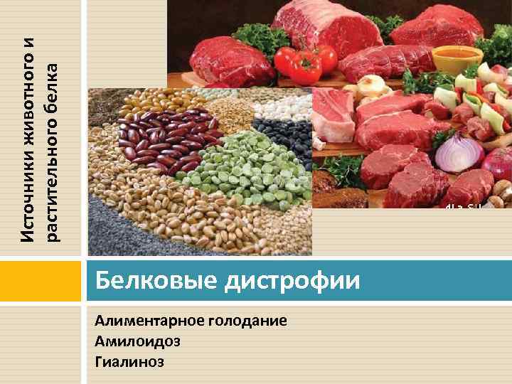 Источники животного и растительного белка Белковые дистрофии Алиментарное голодание Амилоидоз Гиалиноз 