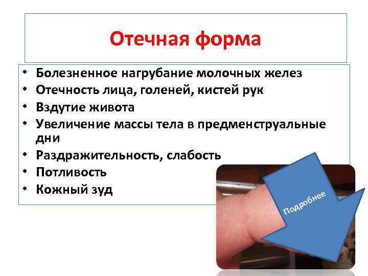 Отечная форма Болезненное нагрубание молочных желез Отечность лица, голеней, кистей рук Вздутие живота Увеличение