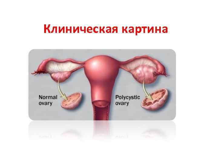 Клиническая картина 