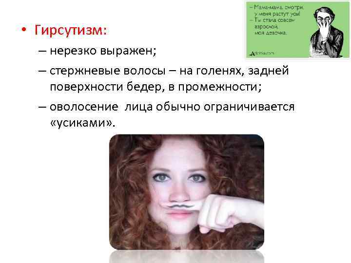  • Гирсутизм: – нерезко выражен; – стержневые волосы – на голенях, задней поверхности