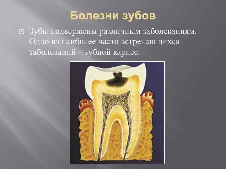 Болезни зубов Зубы подвержены различным заболеваниям. Одно из наиболее часто встречающихся заболеваний – зубной