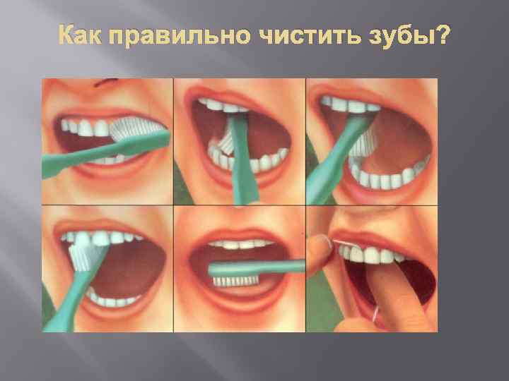 Как правильно чистить зубы? 