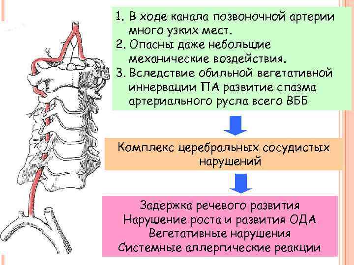 Синдром позвоночной артерии. Ход позвоночных артерий. Каналы позвоночных артерий. Спазма позвоночной артерии. Патология позвоночных артерий.