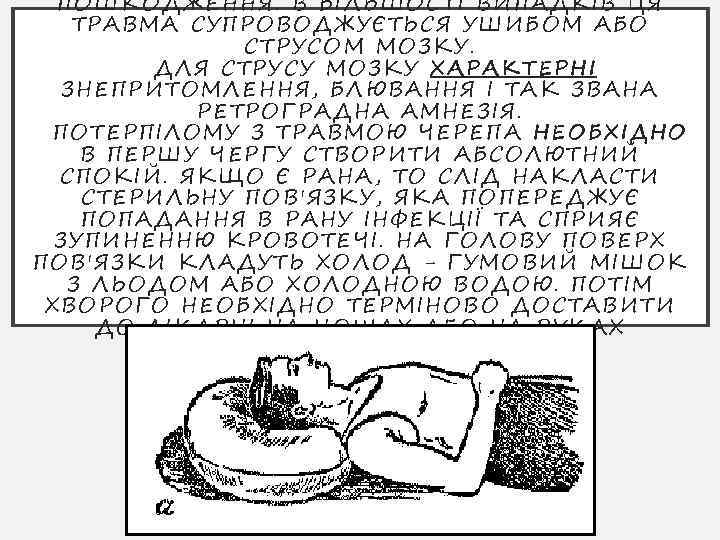 ПОШКО ДЖЕННЯ. В БІЛЬШО СТІ ВИП АДКІВ ЦЯ ТРАВМА СУПРОВ ОД ЖУЄТ ЬСЯ УШ