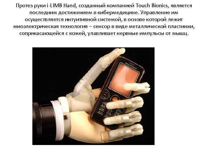 Протез руки i-LIMB Hand, созданный компанией Touch Bionics, является последним достижением в кибермедицине. Управление