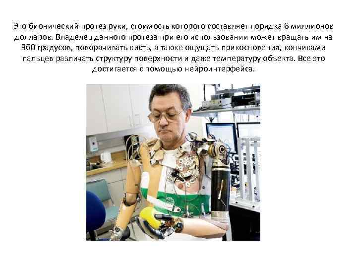Это бионический протез руки, стоимость которого составляет порядка 6 миллионов долларов. Владелец данного протеза