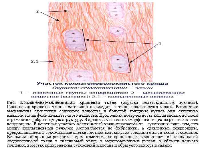 Гиалиновый хрящ рисунок