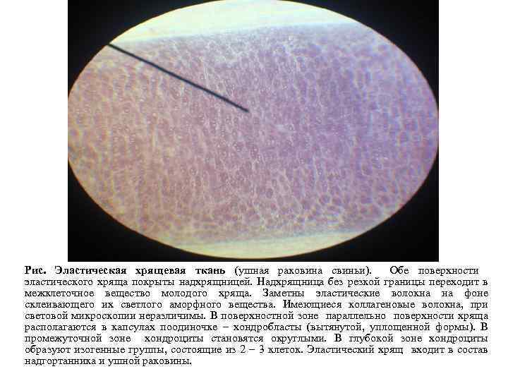 Гиалиновый хрящ рисунок