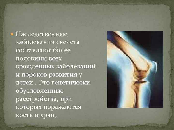  Наследственные заболевания скелета составляют более половины всех врожденных заболеваний и пороков развития у