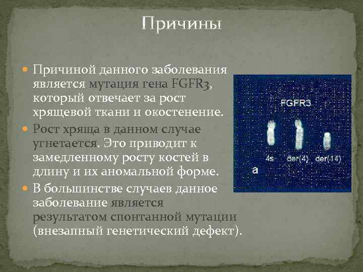 Причины Причиной данного заболевания является мутация гена FGFR 3, который отвечает за рост хрящевой