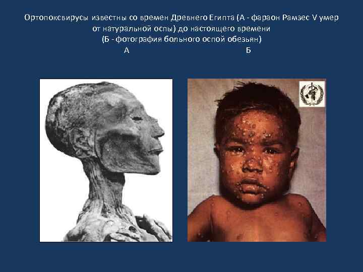 Ортопоксвирусы известны со времен Древнего Египта (А - фараон Рамзес V умер от натуральной