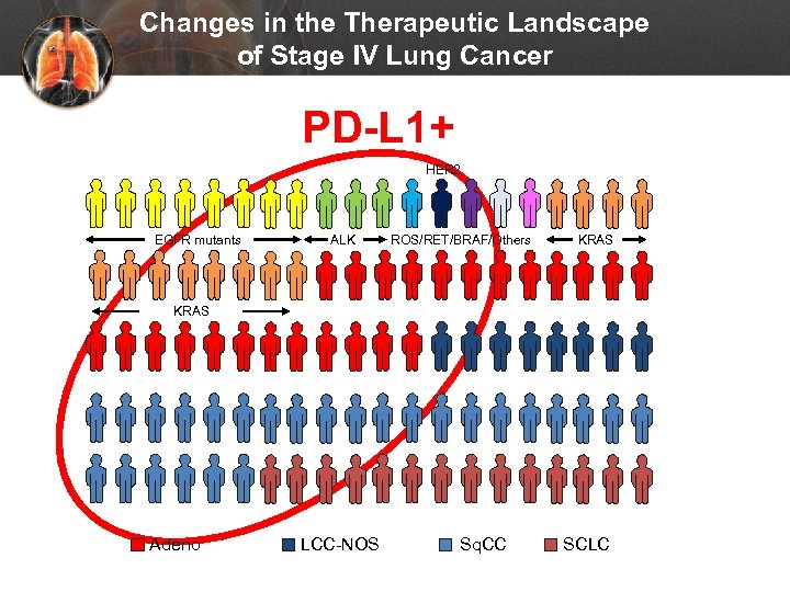 Changes in the Therapeutic Landscape of Stage IV Lung Cancer PD-L 1+ HER 2