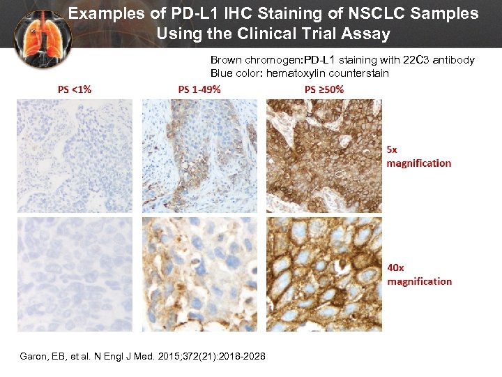 Examples of PD-L 1 IHC Staining of NSCLC Samples Using the Clinical Trial Assay