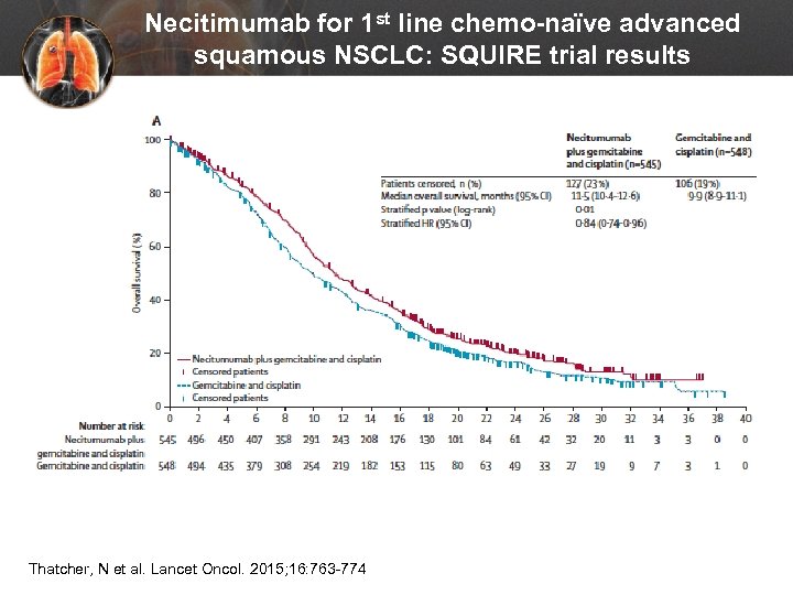 Necitimumab for 1 st line chemo-naïve advanced squamous NSCLC: SQUIRE trial results Thatcher, N