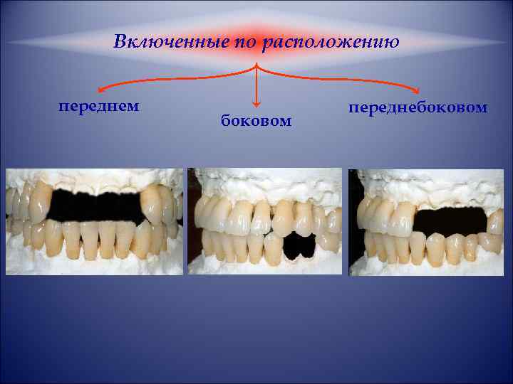 Включенные по расположению переднем боковом переднебоковом 