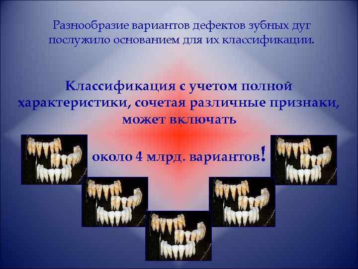Разнообразие вариантов дефектов зубных дуг послужило основанием для их классификации. Классификация с учетом полной
