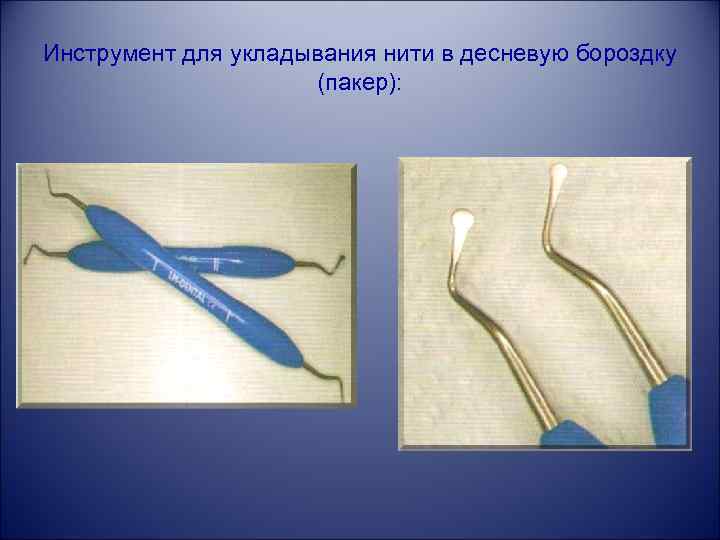 Инструмент для укладывания нити в десневую бороздку (пакер): 
