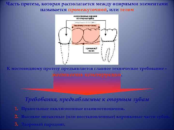 Часть протеза, которая располагается между опорными элементами называется промежуточной, или телом К мостовидному протезу