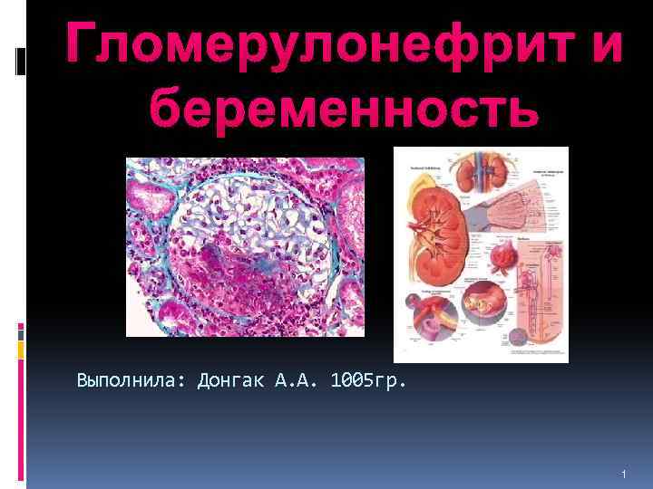 Гломерулонефрит и беременность Выполнила: Донгак А. А. 1005 гр. 1 