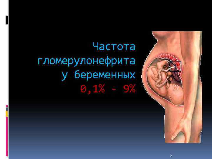 Частота гломерулонефрита у беременных 0, 1% - 9% 2 