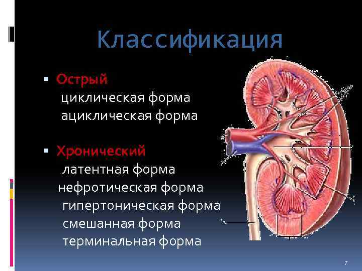 Классификация Острый циклическая форма ациклическая форма Хронический латентная форма нефротическая форма гипертоническая форма смешанная