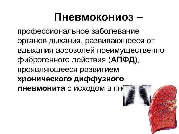 Пневмокониоз – профессиональное заболевание органов дыхания, развивающееся от вдыхания аэрозолей преимущественно фиброгенного действия (АПФД),