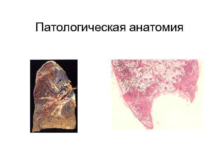 Патологическая анатомия 