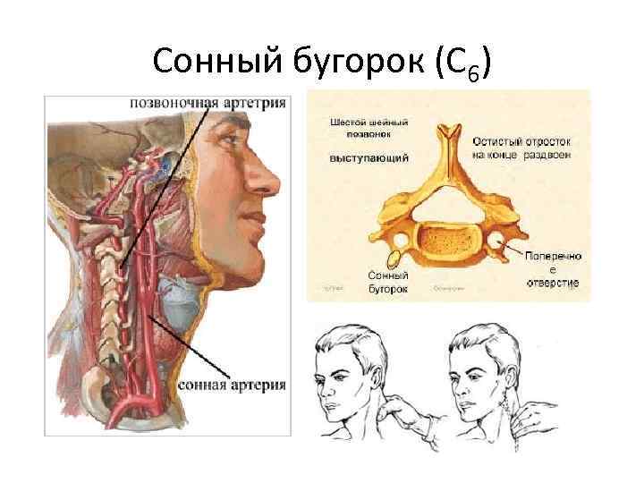 Сонный бугорок (С 6) 