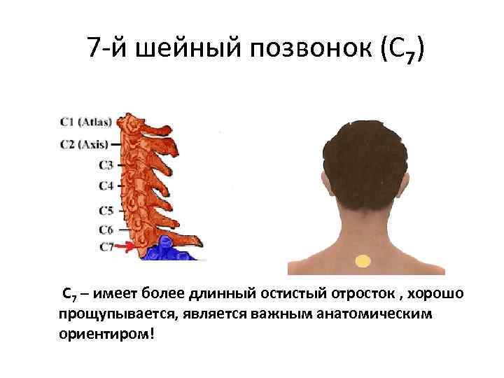  7 -й шейный позвонок (С 7) С 7 – имеет более длинный остистый