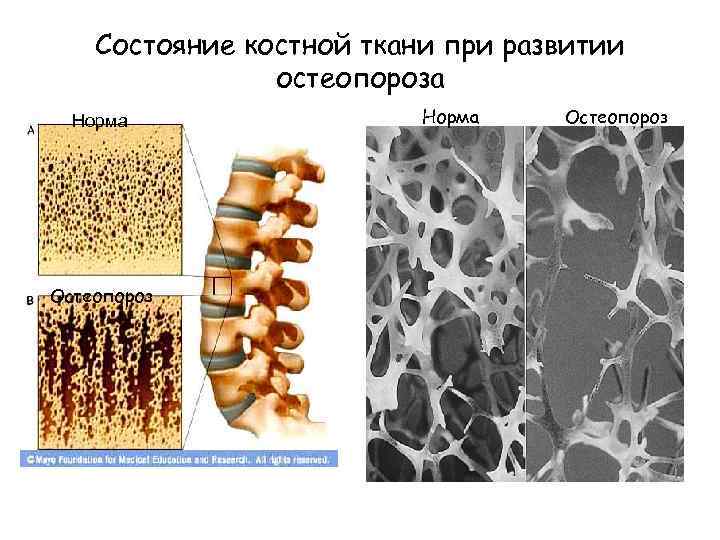 В костной ткани преобладают. Этапы образования костной ткани химия. Минеральный обмен в костной ткани. Химические элементы костной ткани. Мобилизация кальция из костной ткани это.